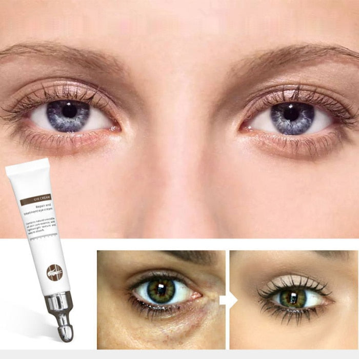 Beauty Anti-Aging Eye Cream Reduces dark circles under puffy eyes.
