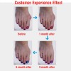 1 pair of silicone foot care Hallux Valgus corrector